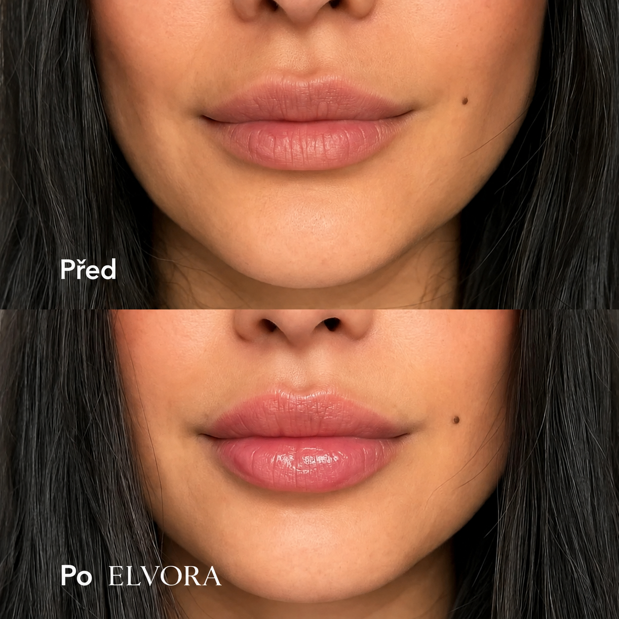 ZDARMA Elvora: Hyaluronic Acid Lip Plumper